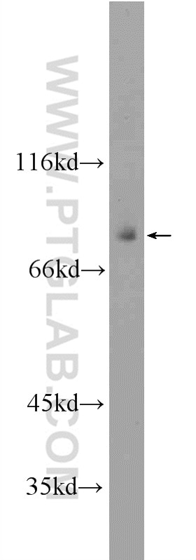 Western Blot (WB) analysis of mouse skeletal muscle tissue using TAP1 Polyclonal antibody (11114-1-AP)