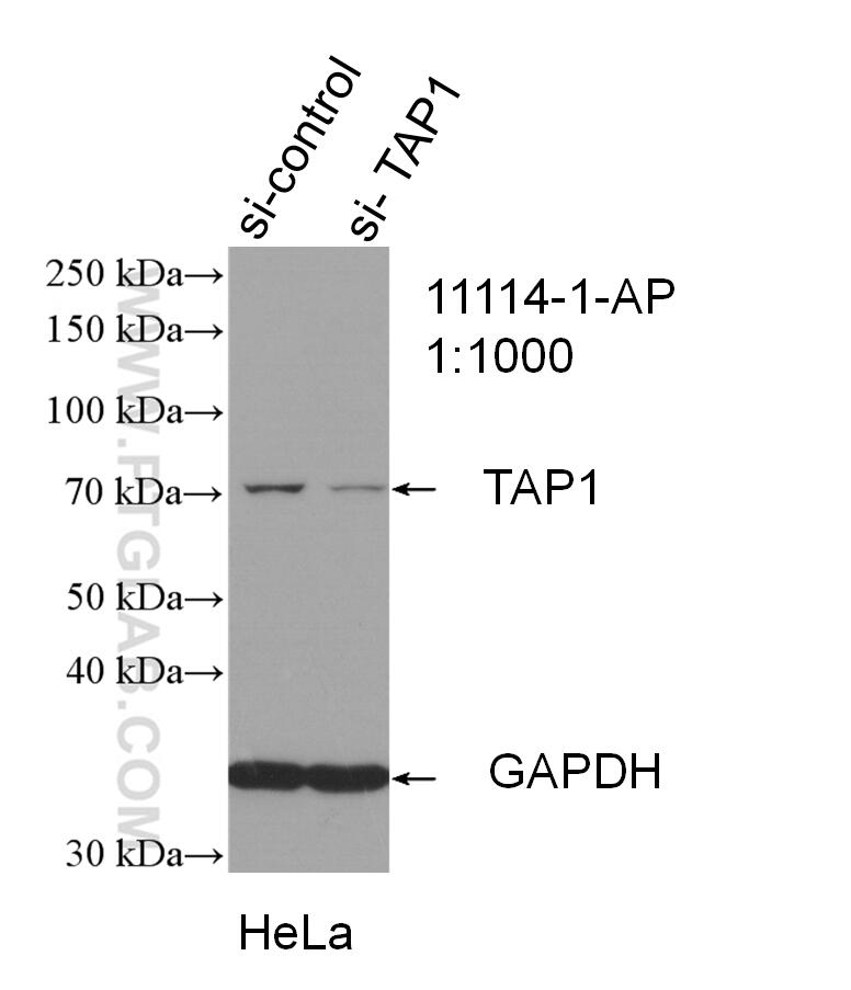 Western Blot (WB) analysis of HeLa cells using TAP1 Polyclonal antibody (11114-1-AP)