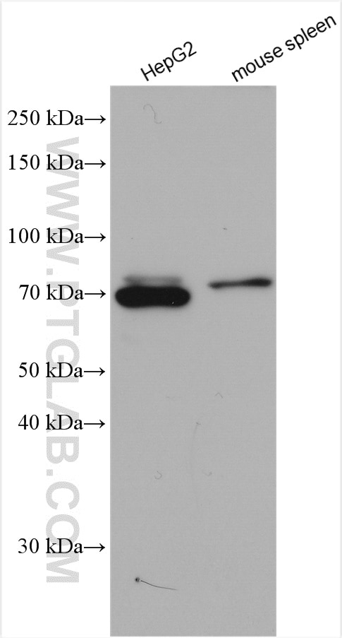 Western Blot (WB) analysis of various lysates using TAP1 Polyclonal antibody (11114-1-AP)