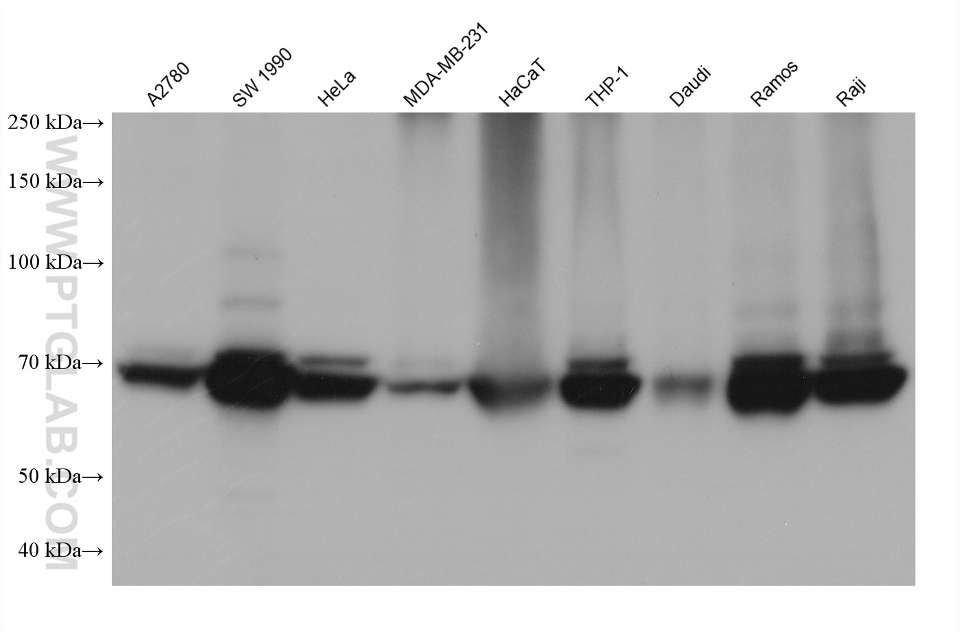 Western Blot (WB) analysis of various lysates using TAP1 Monoclonal antibody (68412-1-Ig)
