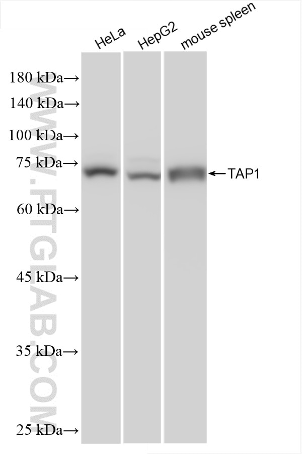 Western Blot (WB) analysis of various lysates using TAP1 Recombinant antibody (85766-4-RR)