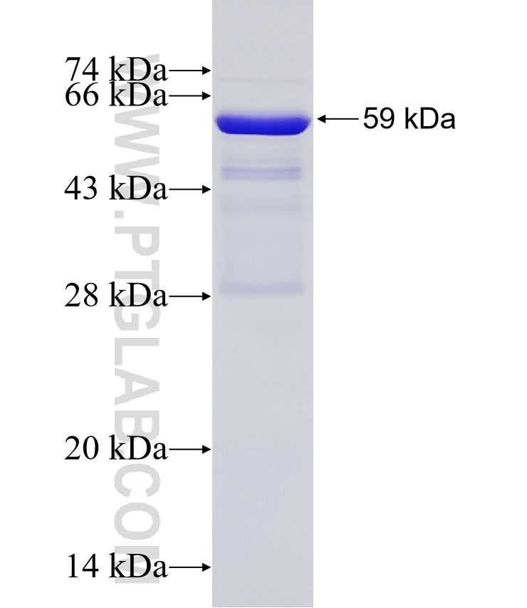 TAP1 fusion protein Ag1619 SDS-PAGE
