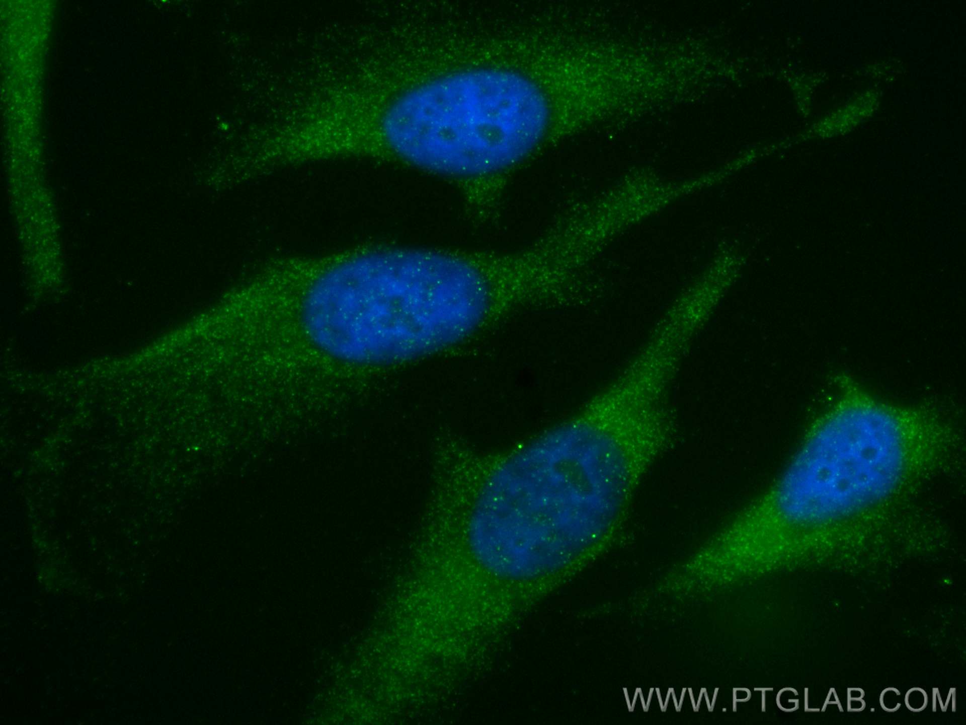 Immunofluorescence (IF) / fluorescent staining of HeLa cells using TAPBP Polyclonal antibody (30500-1-AP)