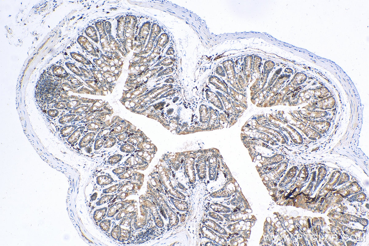 Immunohistochemistry (IHC) staining of mouse colon tissue using TAPBP Polyclonal antibody (30500-1-AP)