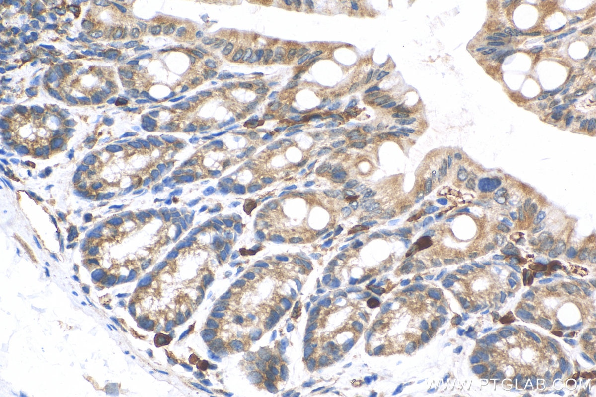 Immunohistochemistry (IHC) staining of mouse colon tissue using TAPBP Polyclonal antibody (30500-1-AP)