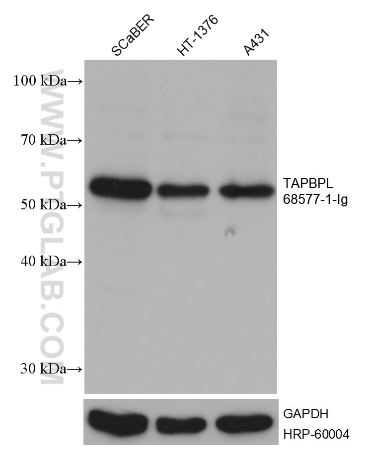 Western Blot (WB) analysis of various lysates using TAPBPL Monoclonal antibody (68577-1-Ig)