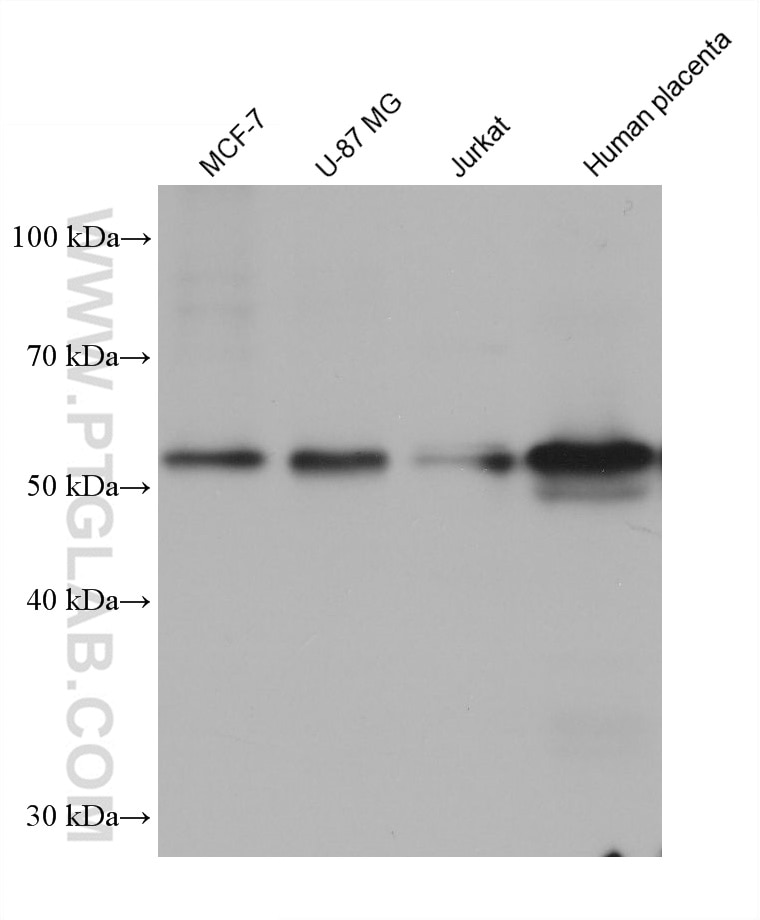 Western Blot (WB) analysis of various lysates using TAPBPL Monoclonal antibody (68577-1-Ig)