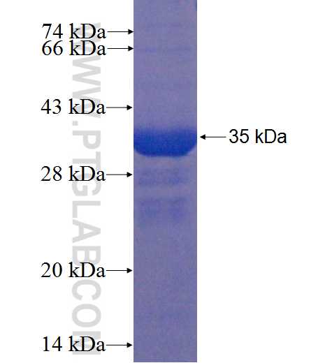 TARBP1 fusion protein Ag22675 SDS-PAGE