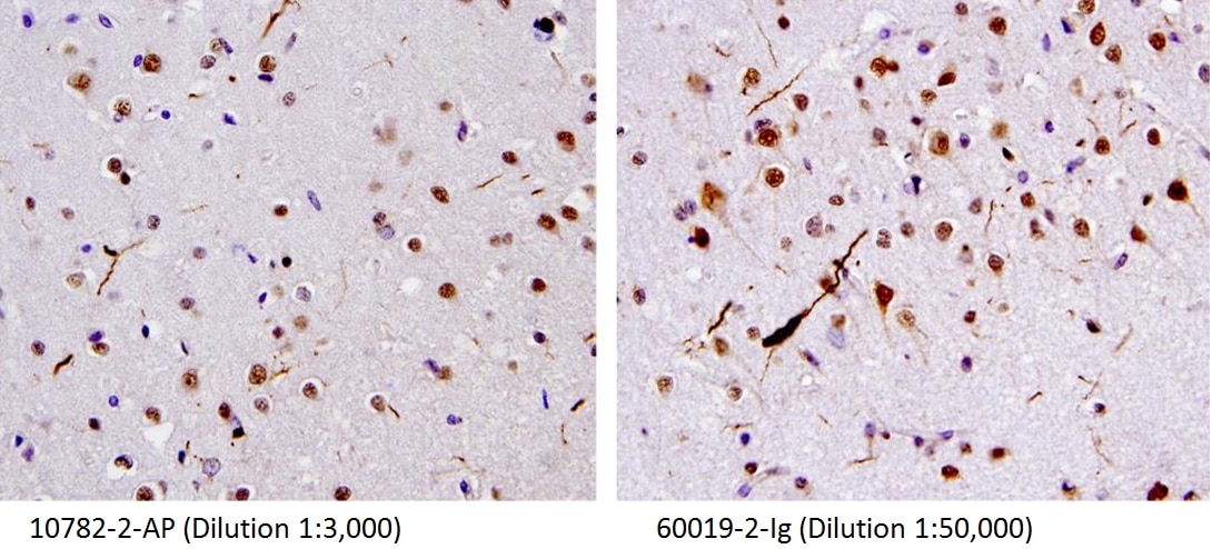 IHC staining of human brain (FTLD-U) tissue using 10782-2-AP