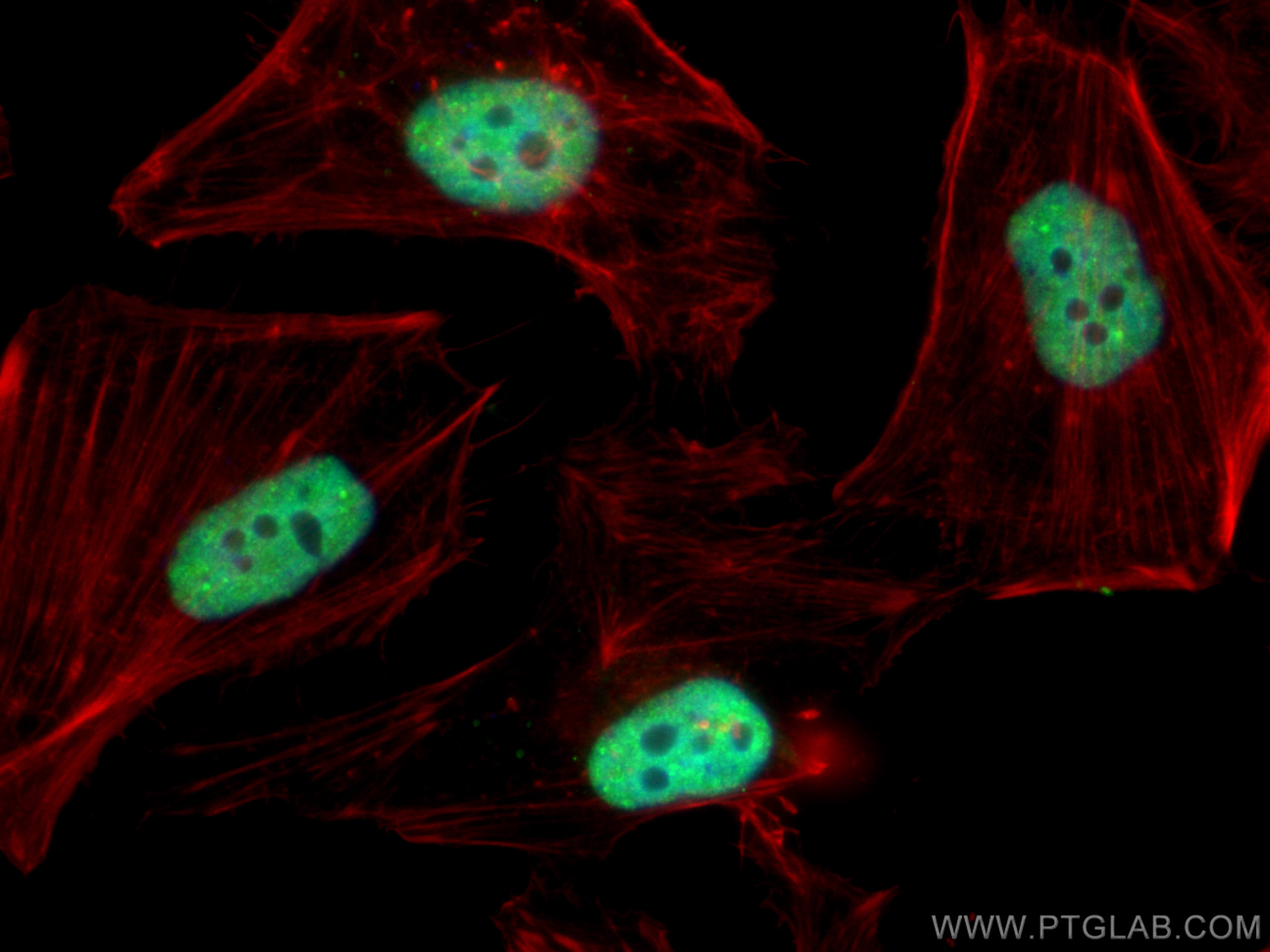 Immunofluorescence (IF) / fluorescent staining of HeLa cells using TDP-43 Polyclonal antibody (10782-2-AP)