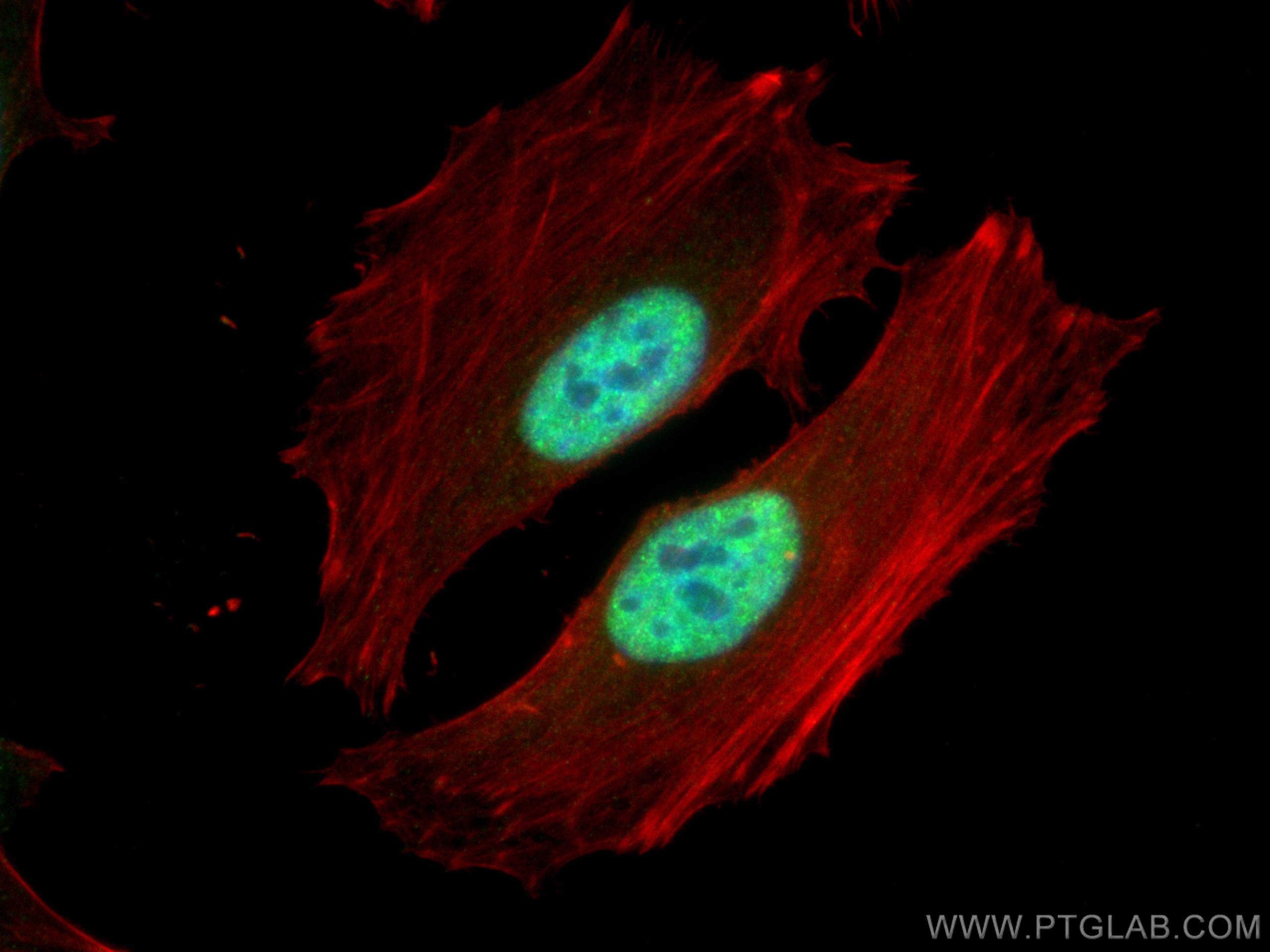 IF Staining of HeLa using 10782-2-AP