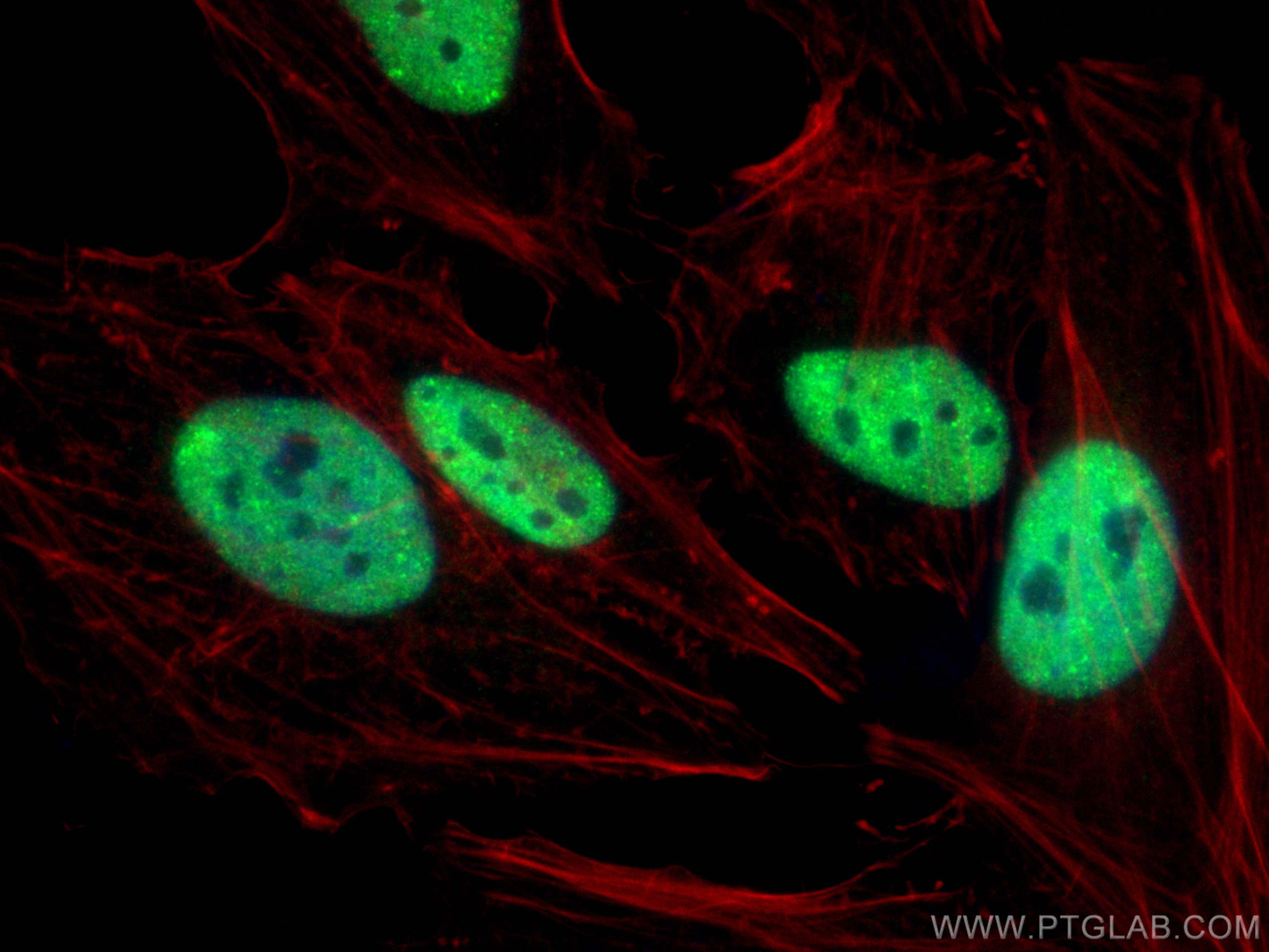 Immunofluorescence (IF) / fluorescent staining of HeLa cells using TDP-43 Polyclonal antibody (10782-2-AP)