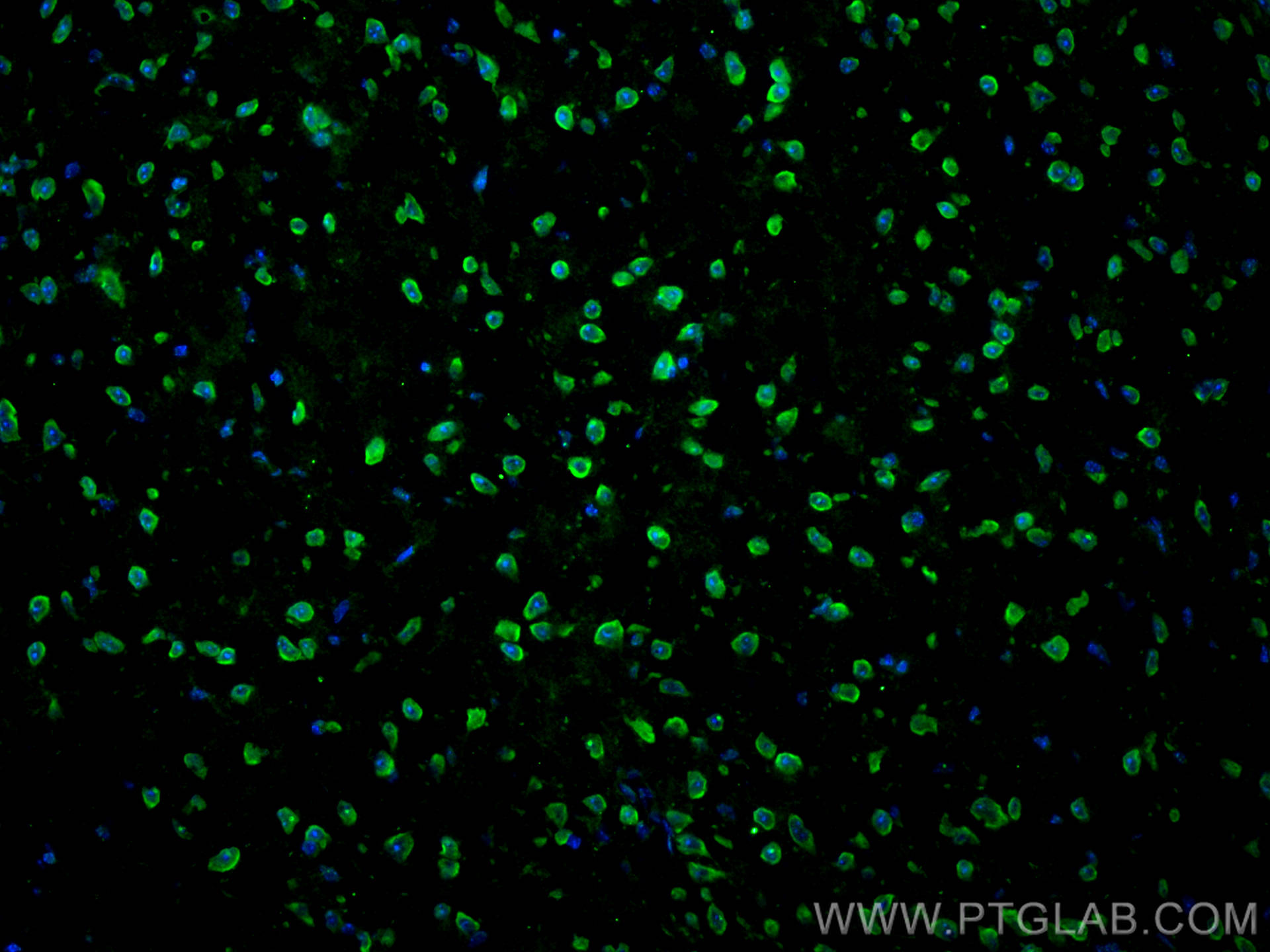 Immunofluorescence (IF) / fluorescent staining of mouse brain tissue using TDP-43 Polyclonal antibody (10782-2-AP)
