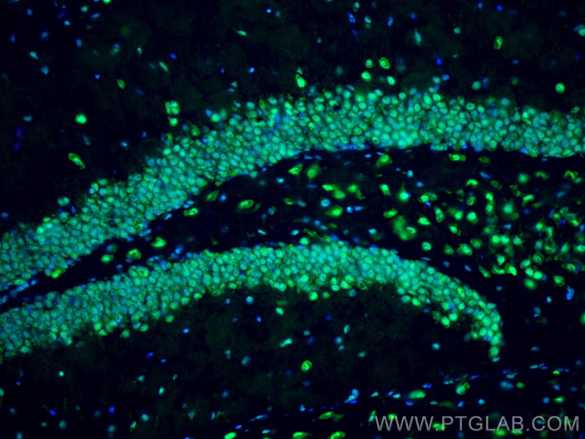 Immunofluorescence (IF) / fluorescent staining of mouse brain tissue using TDP-43 Polyclonal antibody (10782-2-AP)