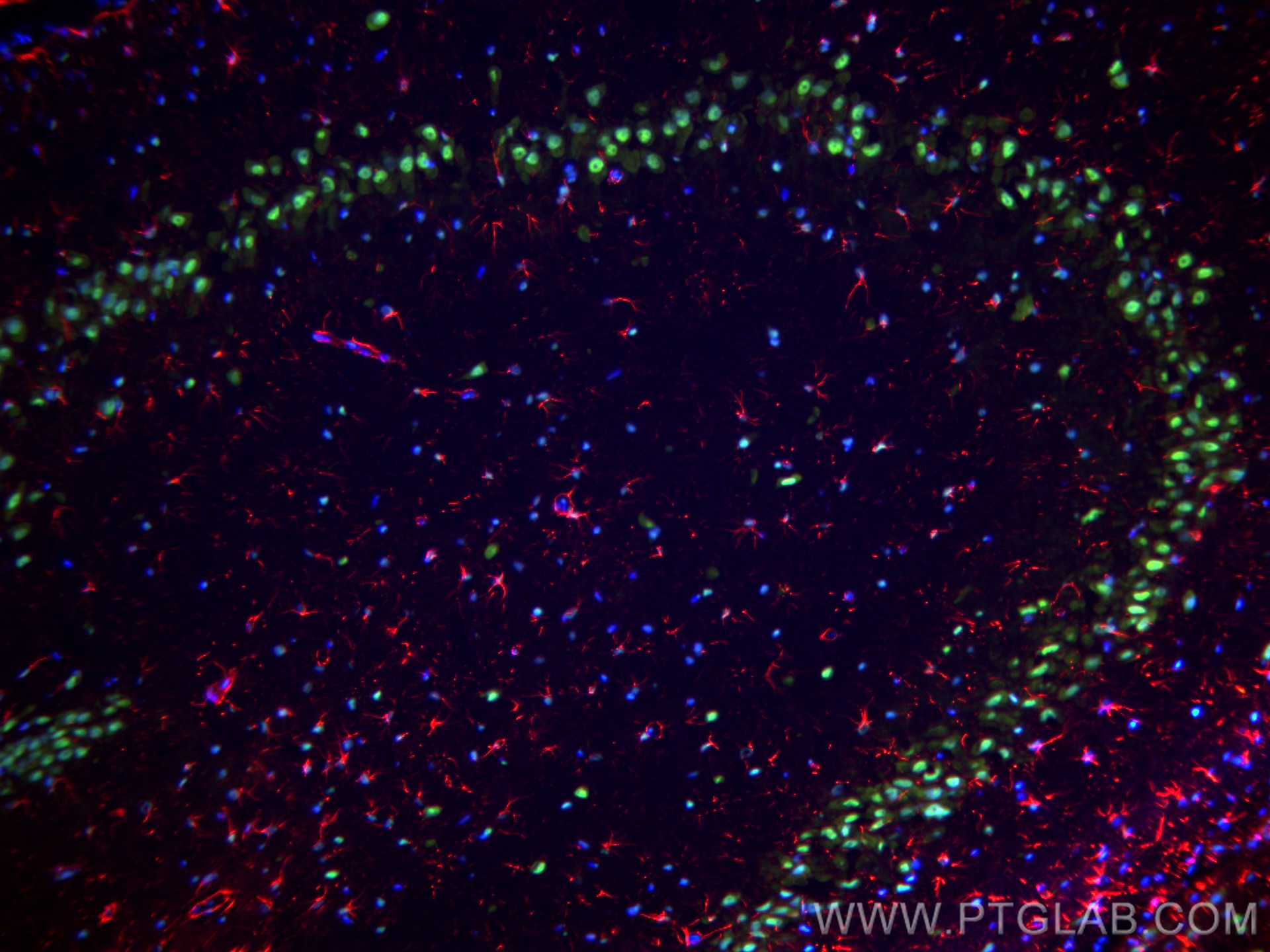 Immunofluorescence (IF) / fluorescent staining of rat brain tissue using TDP-43 Polyclonal antibody (10782-2-AP)