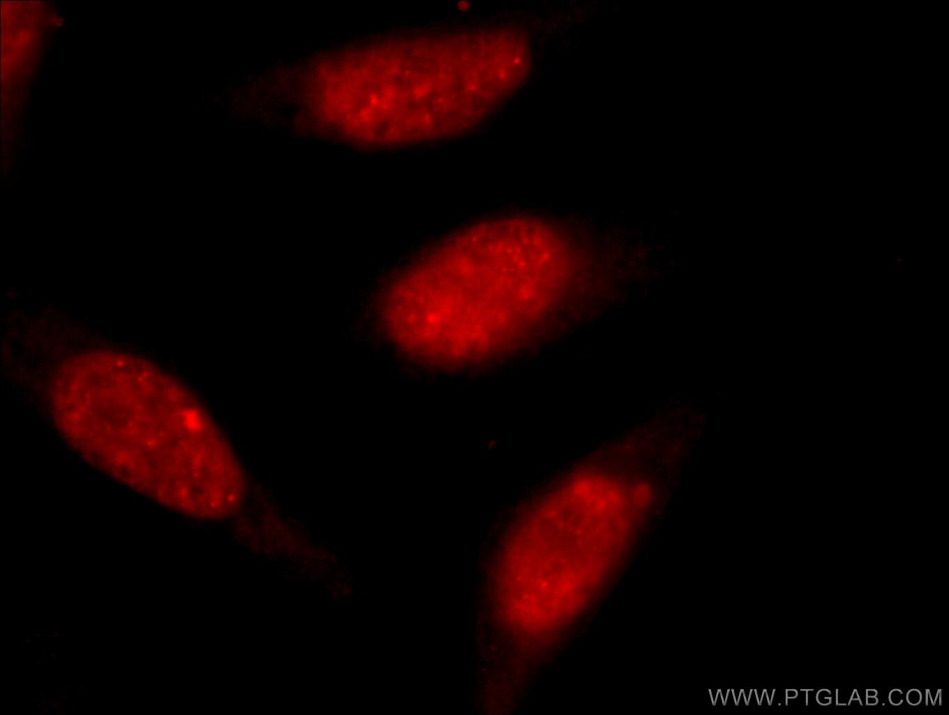 TDP-43 (N-terminal) Polyclonal antibody