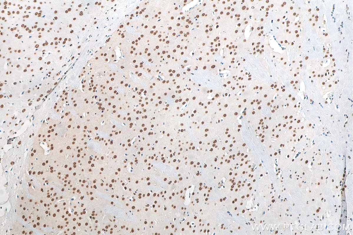 Immunohistochemistry (IHC) staining of mouse brain tissue using TDP-43 Polyclonal antibody (10782-2-AP)