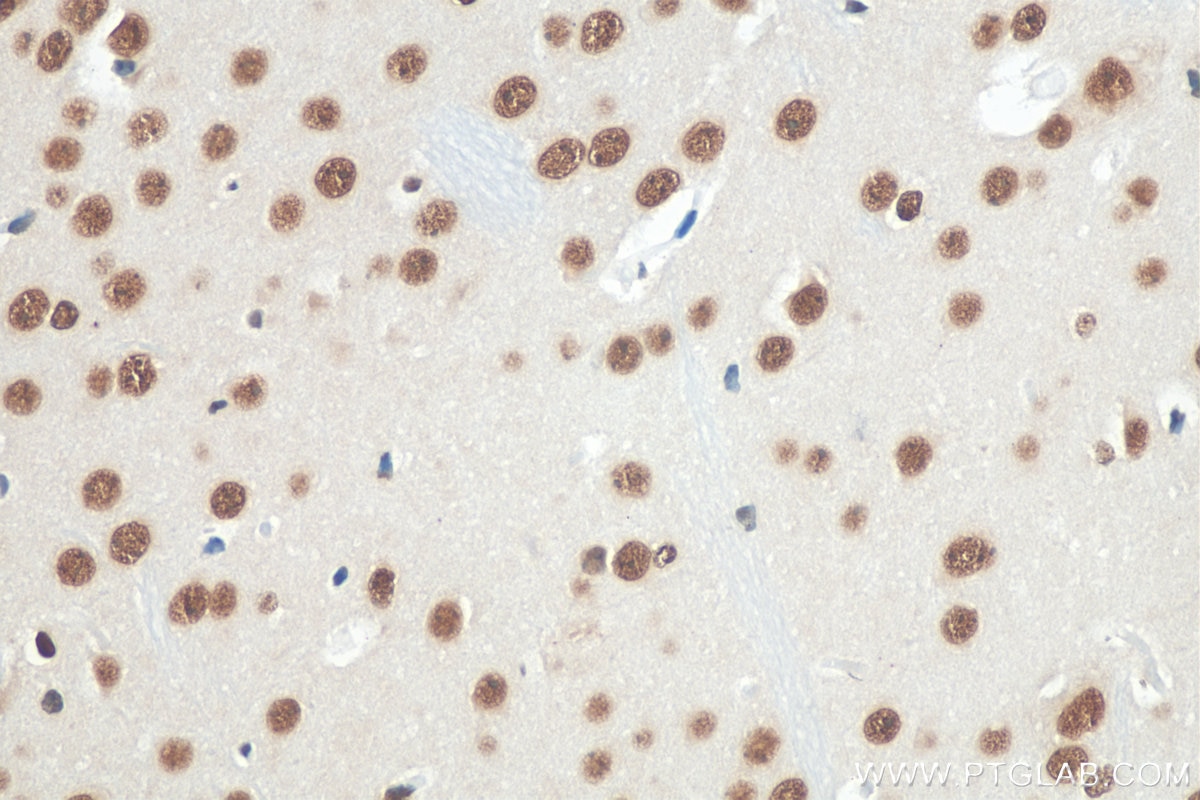 Immunohistochemistry (IHC) staining of mouse brain tissue using TDP-43 Polyclonal antibody (10782-2-AP)