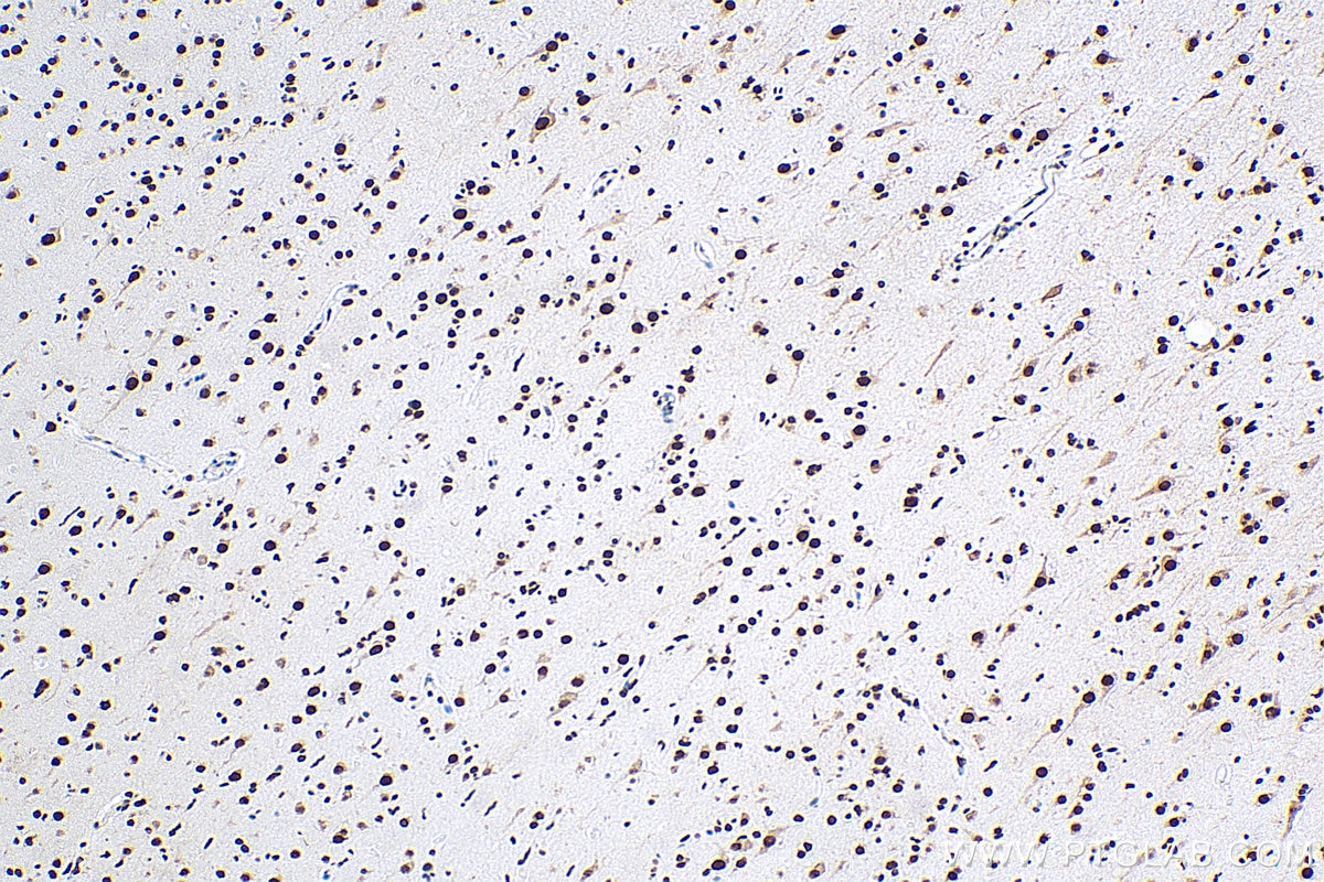 IHC staining of human gliomas using 10782-2-AP