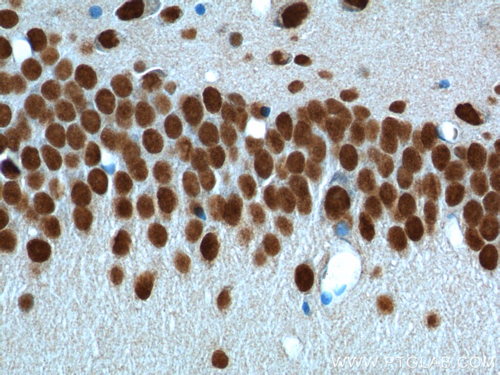 IHC staining of rat brain using 10782-2-AP
