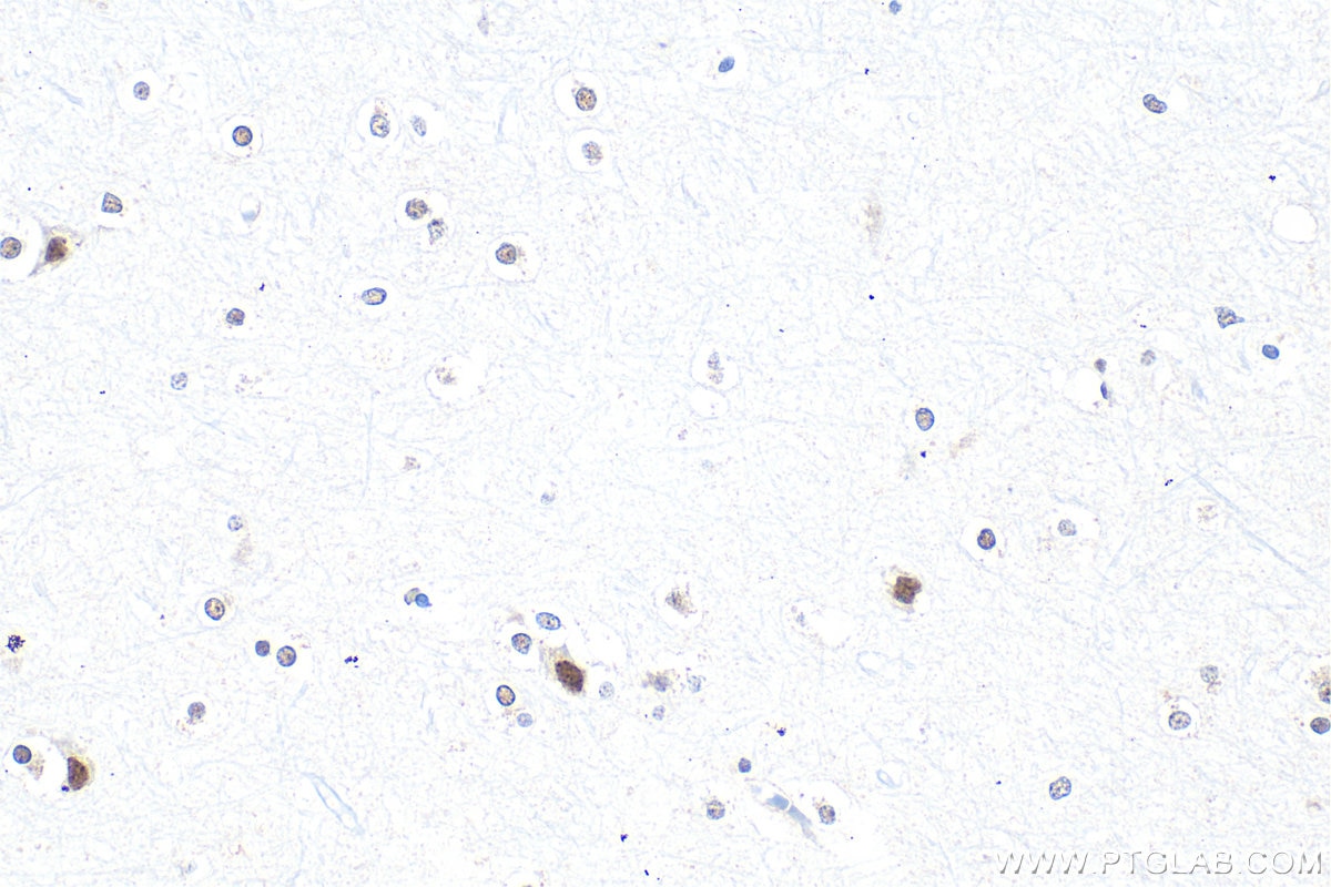 Immunohistochemistry (IHC) staining of human brain tissue using TDP-43 Polyclonal antibody (10782-2-AP)