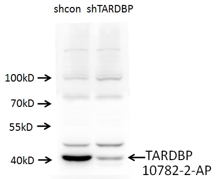TDP-43 Polyclonal antibody