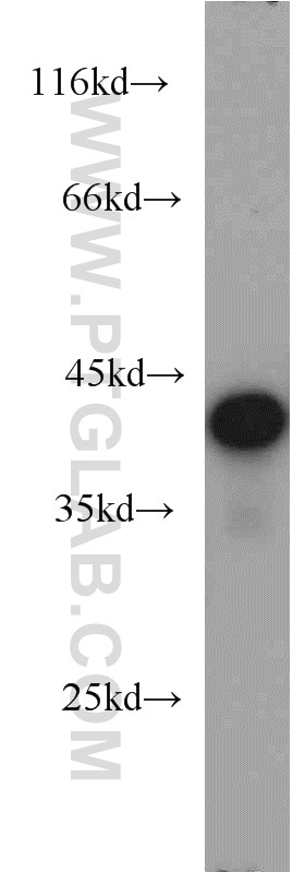 TDP-43 (N-terminal) Polyclonal antibody
