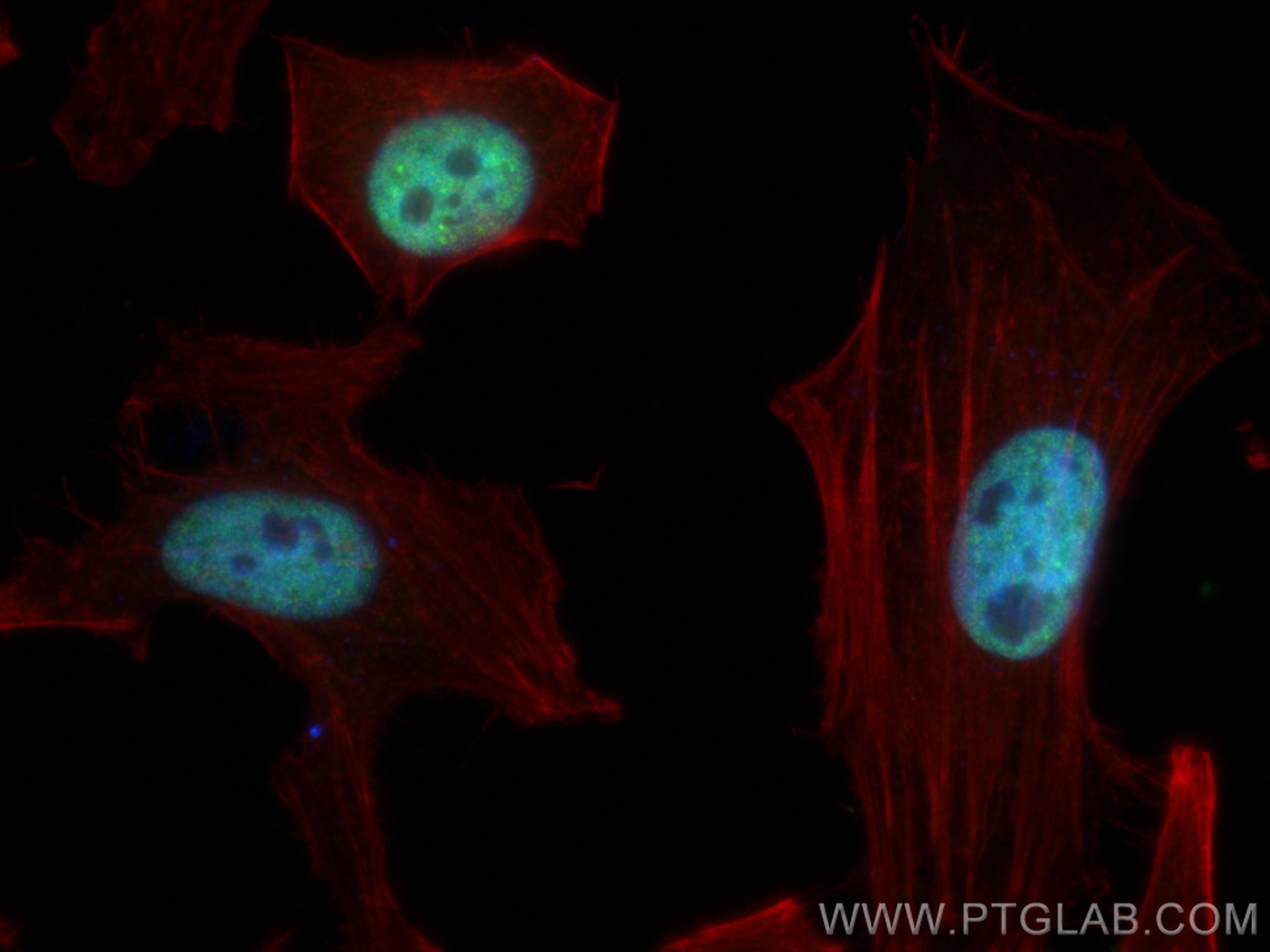 Immunofluorescence (IF) / fluorescent staining of HeLa cells using TDP-43 (C-terminal) Polyclonal antibody (12892-1-AP)