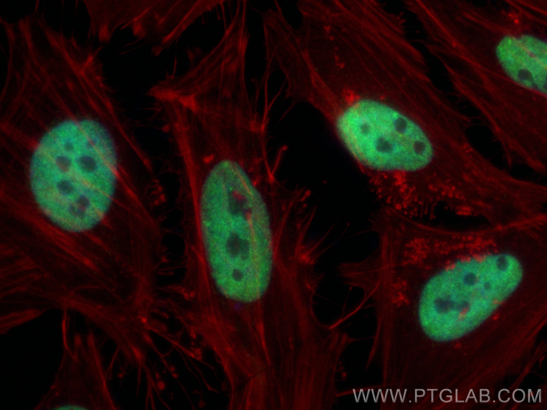 Immunofluorescence (IF) / fluorescent staining of HeLa cells using TDP-43 (C-terminal) Polyclonal antibody (12892-1-AP)