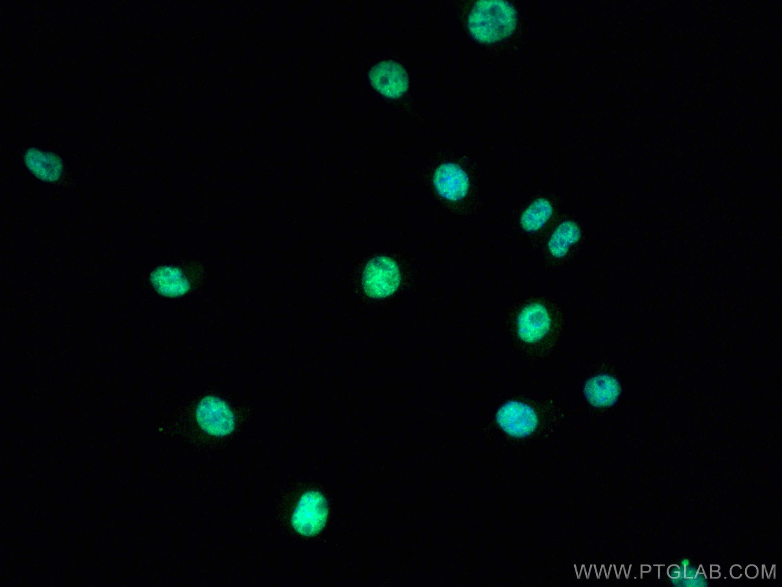 IF Staining of Neuro-2a using 12892-1-AP