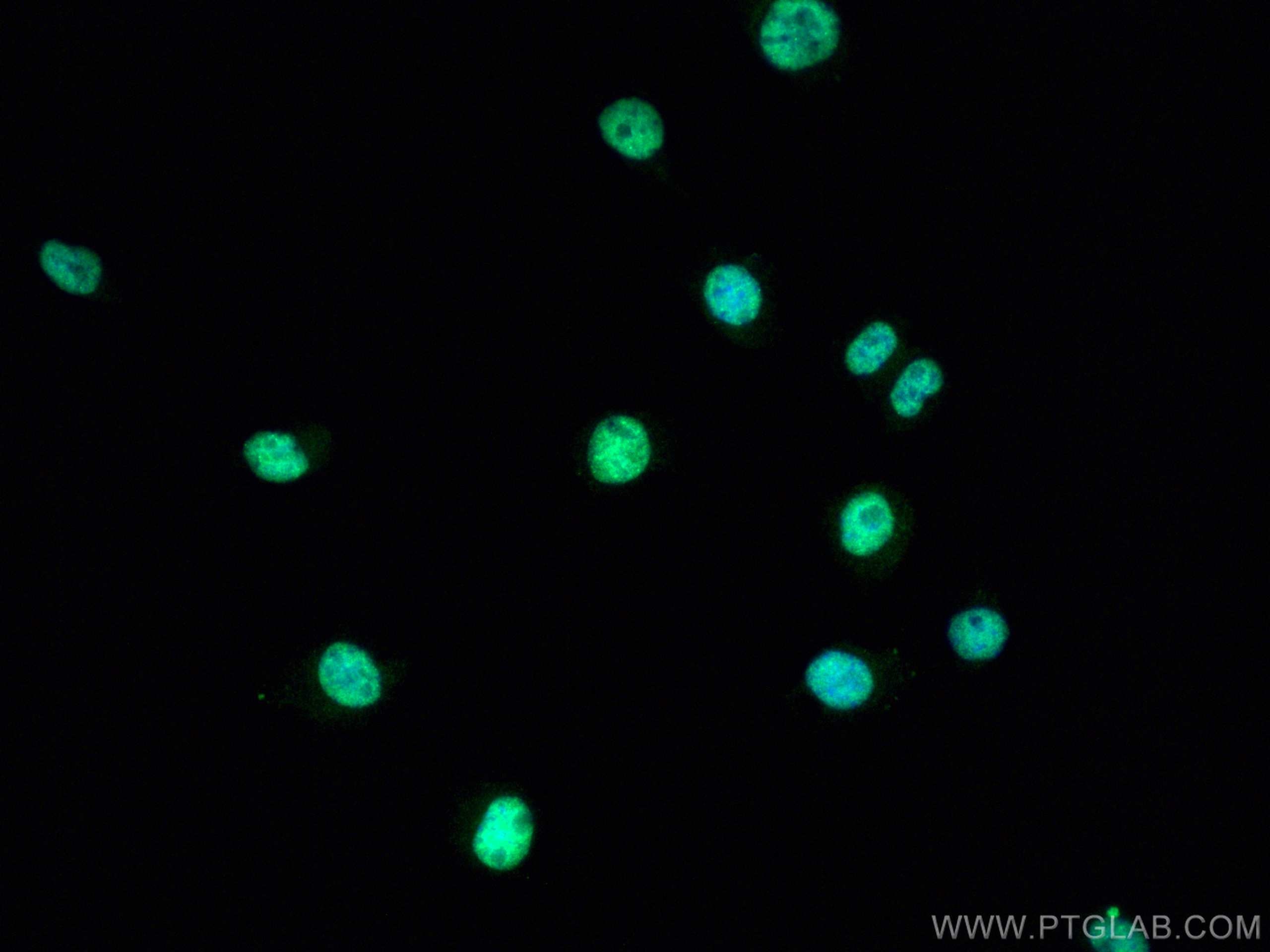 Immunofluorescence (IF) / fluorescent staining of Neuro-2a cells using TDP-43 (C-terminal) Polyclonal antibody (12892-1-AP)