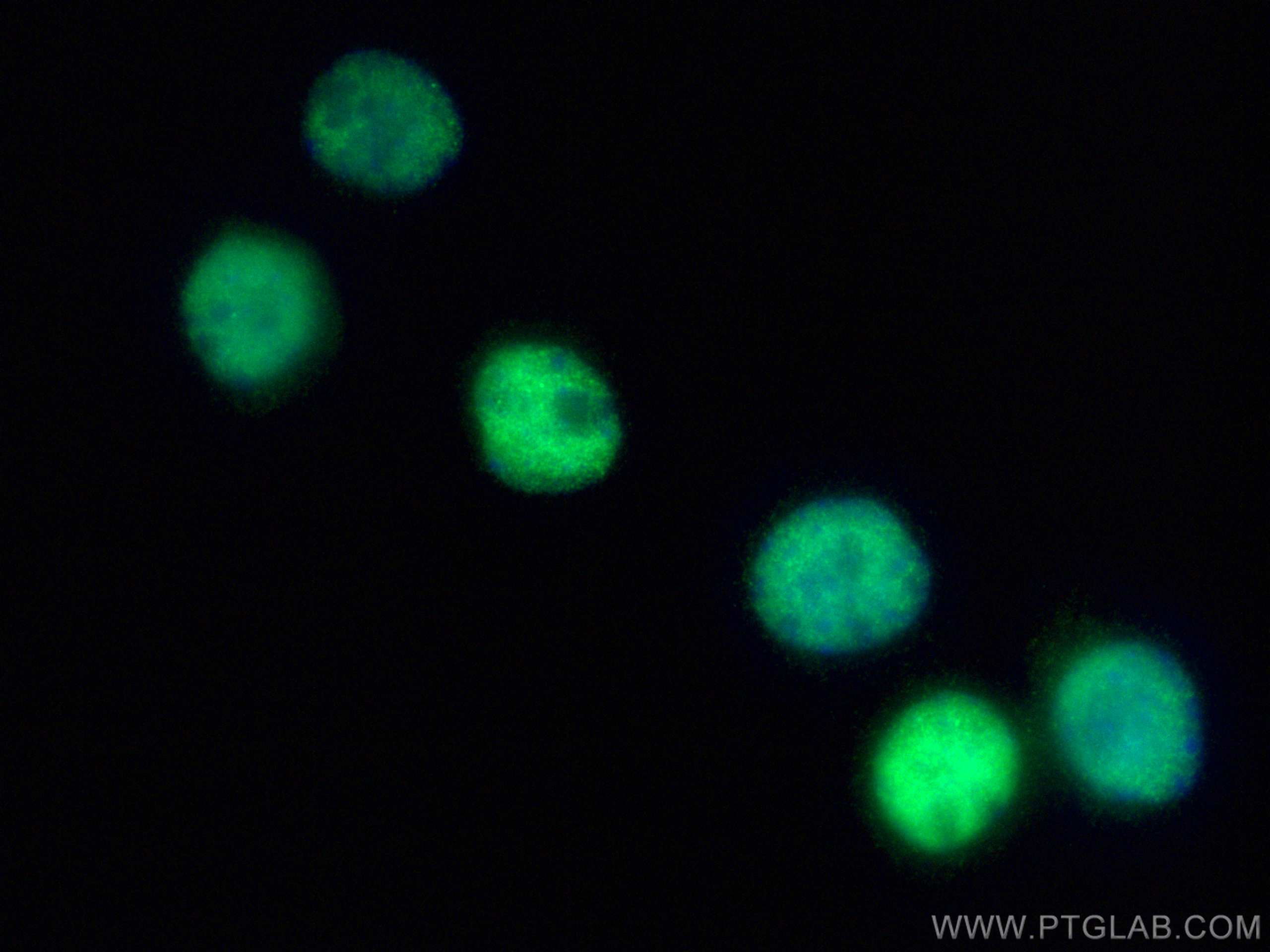Immunofluorescence (IF) / fluorescent staining of Neuro-2a cells using TDP-43 (C-terminal) Polyclonal antibody (12892-1-AP)