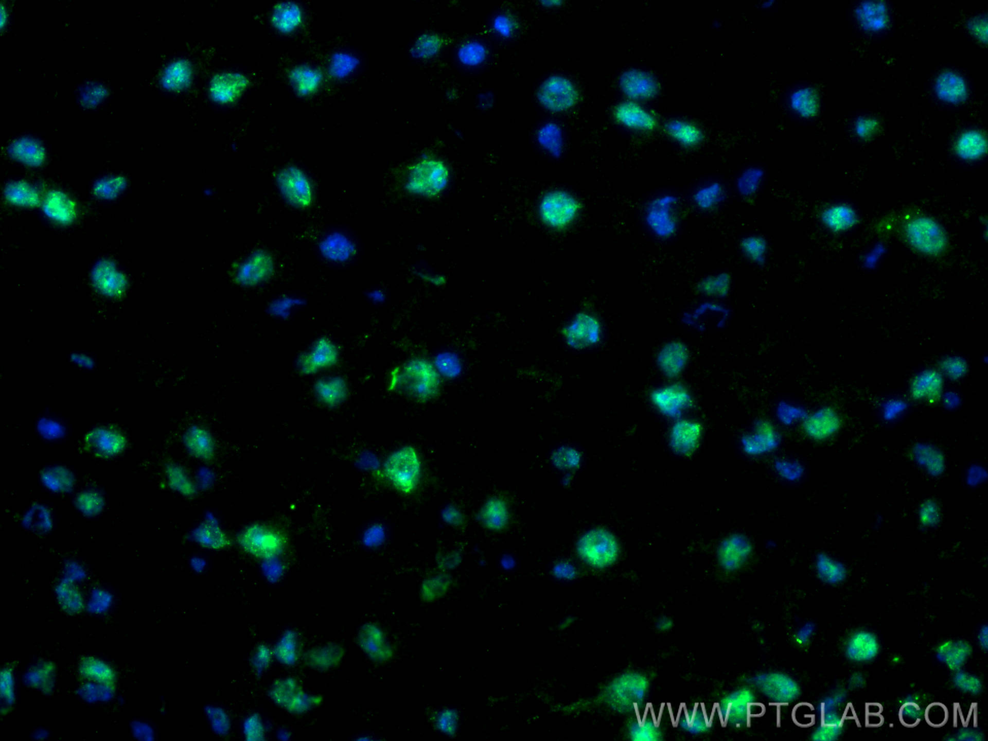 Immunofluorescence (IF) / fluorescent staining of mouse brain tissue using TDP-43 (C-terminal) Polyclonal antibody (12892-1-AP)