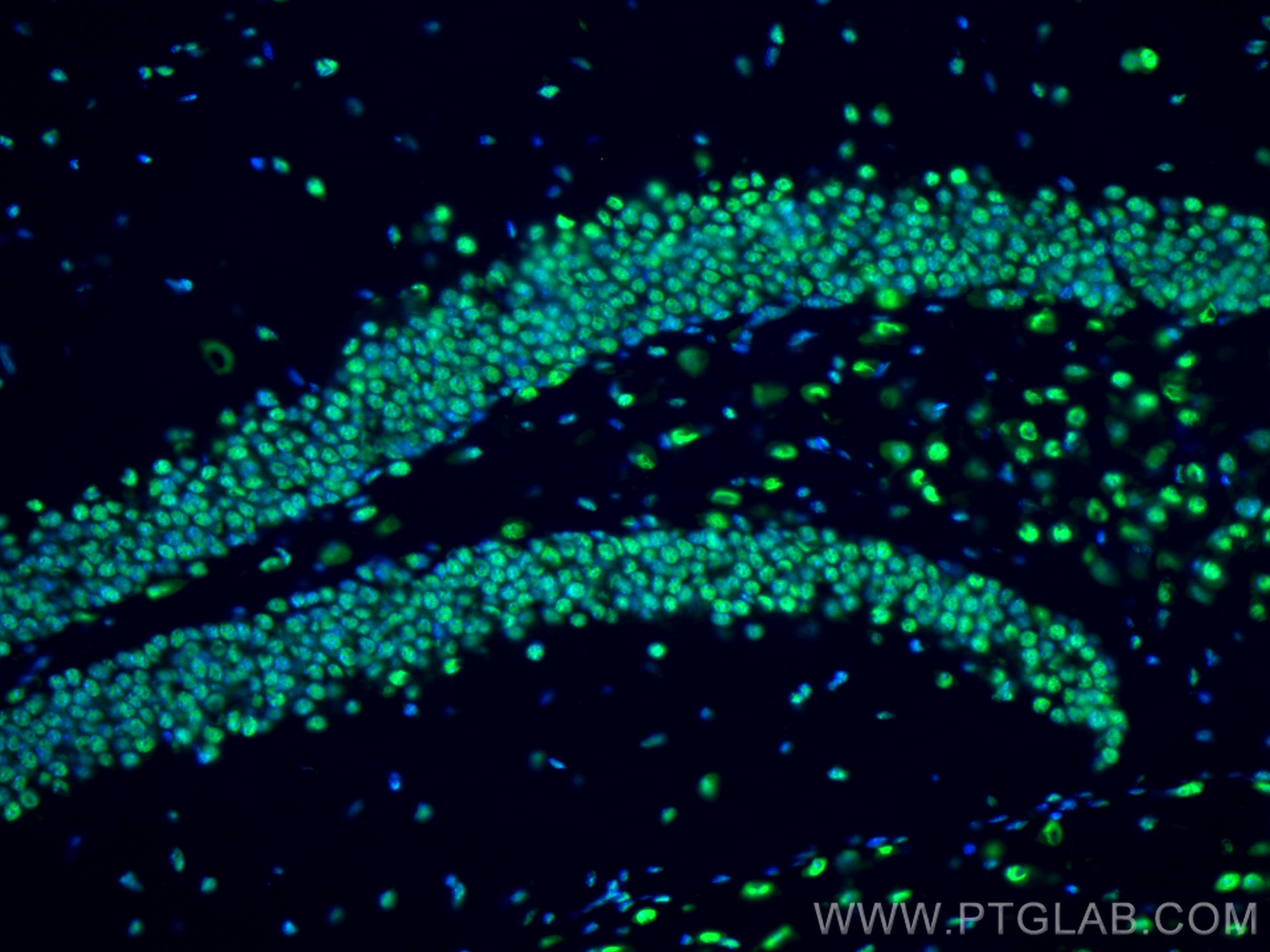 Immunofluorescence (IF) / fluorescent staining of mouse brain tissue using TDP-43 (C-terminal) Polyclonal antibody (12892-1-AP)