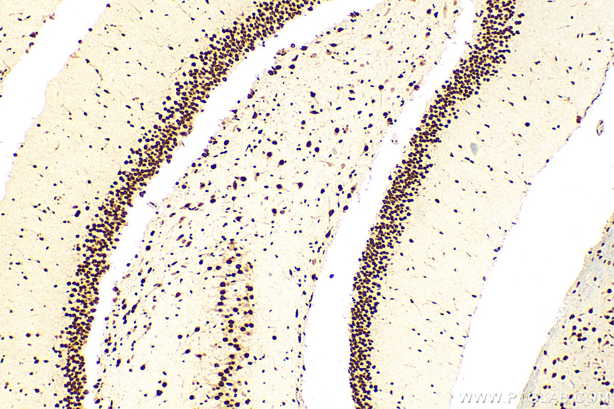 Immunohistochemistry (IHC) staining of rat brain tissue using TDP-43 (C-terminal) Polyclonal antibody (12892-1-AP)