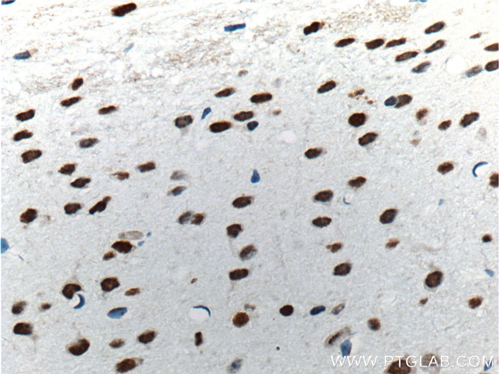Immunohistochemistry (IHC) staining of mouse brain tissue using TDP-43 (C-terminal) Polyclonal antibody (12892-1-AP)