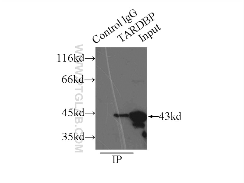 Immunoprecipitation (IP) experiment of HeLa cells using TDP-43 (C-terminal) Polyclonal antibody (12892-1-AP)