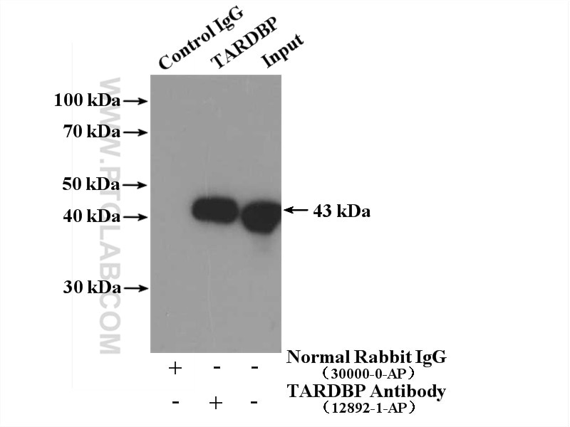 Immunoprecipitation (IP) experiment of mouse brain tissue using TDP-43 (C-terminal) Polyclonal antibody (12892-1-AP)