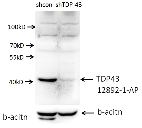 Western Blot (WB) analysis of A549 cells using TDP-43 (C-terminal) Polyclonal antibody (12892-1-AP)