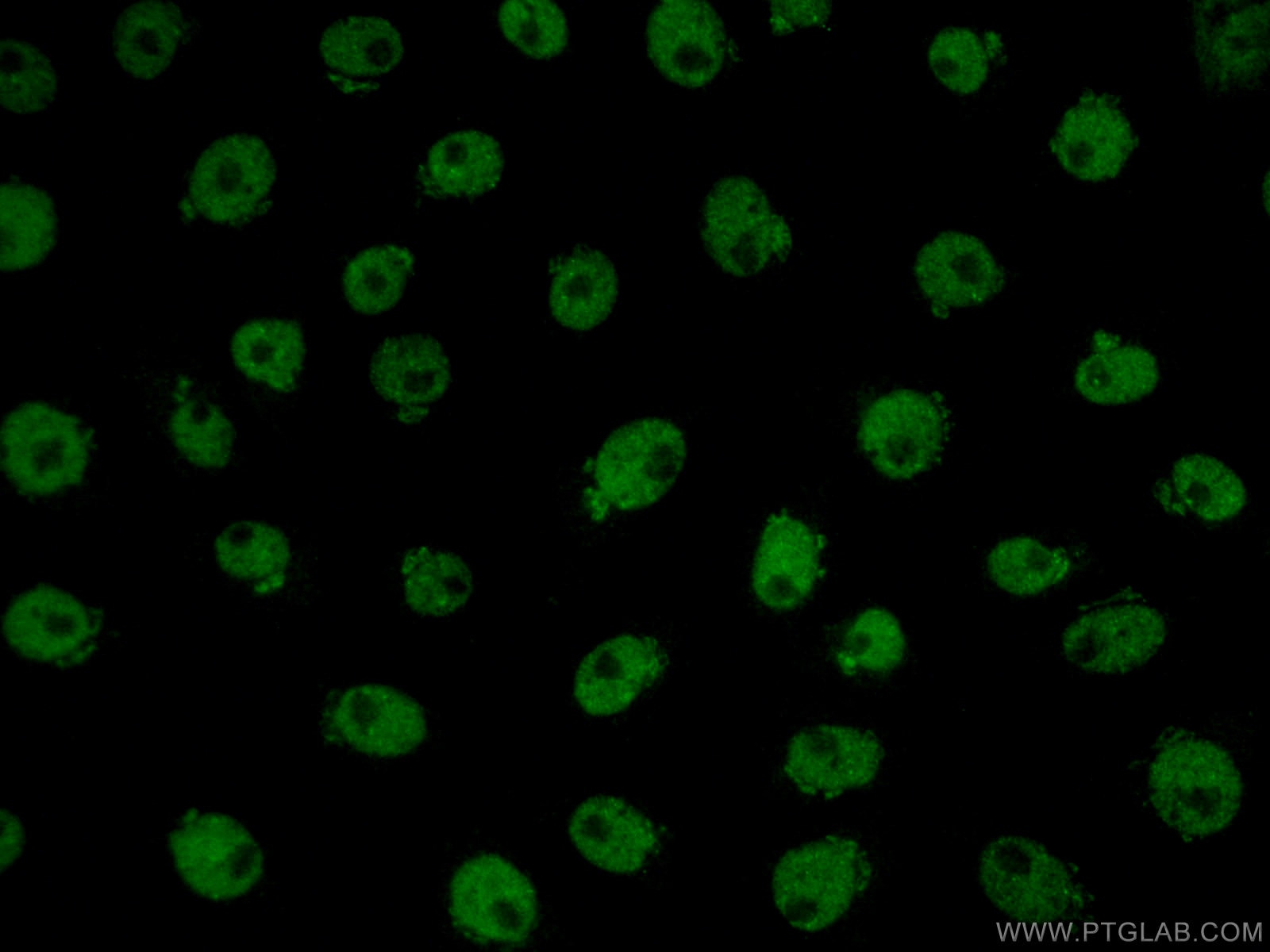 Immunofluorescence (IF) / fluorescent staining of SH-SY5Y cells using TDP-43 Polyclonal antibody (18280-1-AP)