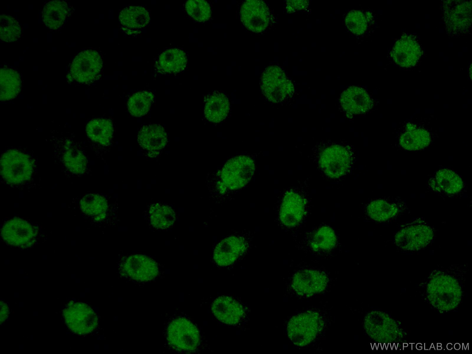 IF Staining of SH-SY5Y using 18280-1-AP