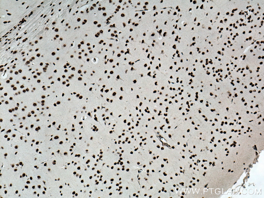 Immunohistochemistry (IHC) staining of mouse brain tissue using TDP-43 Polyclonal antibody (18280-1-AP)