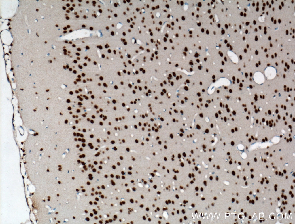 Immunohistochemistry (IHC) staining of rat brain tissue using TDP-43 Polyclonal antibody (18280-1-AP)