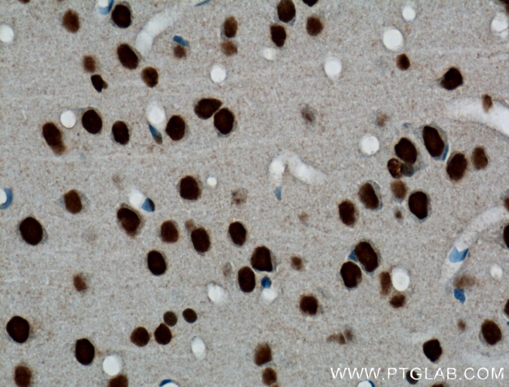 Immunohistochemistry (IHC) staining of rat brain tissue using TDP-43 Polyclonal antibody (18280-1-AP)