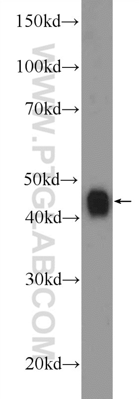 Western Blot (WB) analysis of HeLa cells using TDP-43 Polyclonal antibody (18280-1-AP)