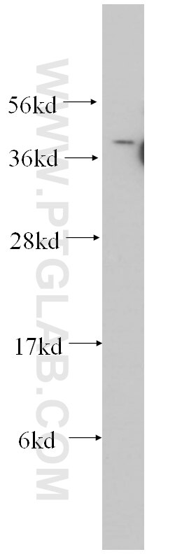 Western Blot (WB) analysis of human brain tissue using TDP-43 Monoclonal antibody (60019-1-Ig)