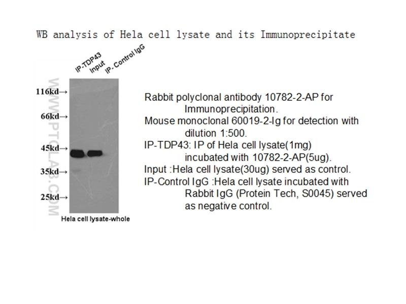 TDP-43 (human specific)