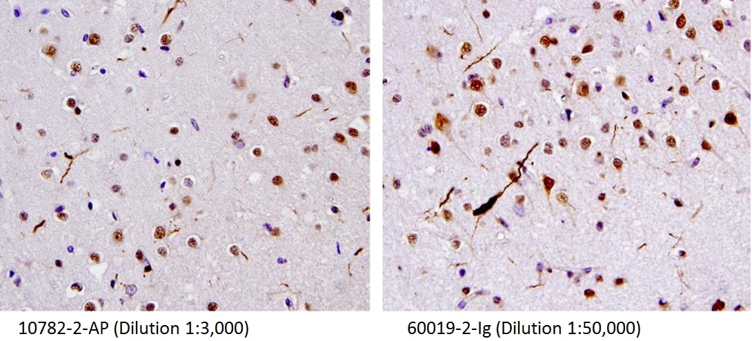Immunohistochemistry (IHC) staining of human brain(FTLD-U) tissue using TDP-43 (human specific) Monoclonal antibody (60019-2-Ig)