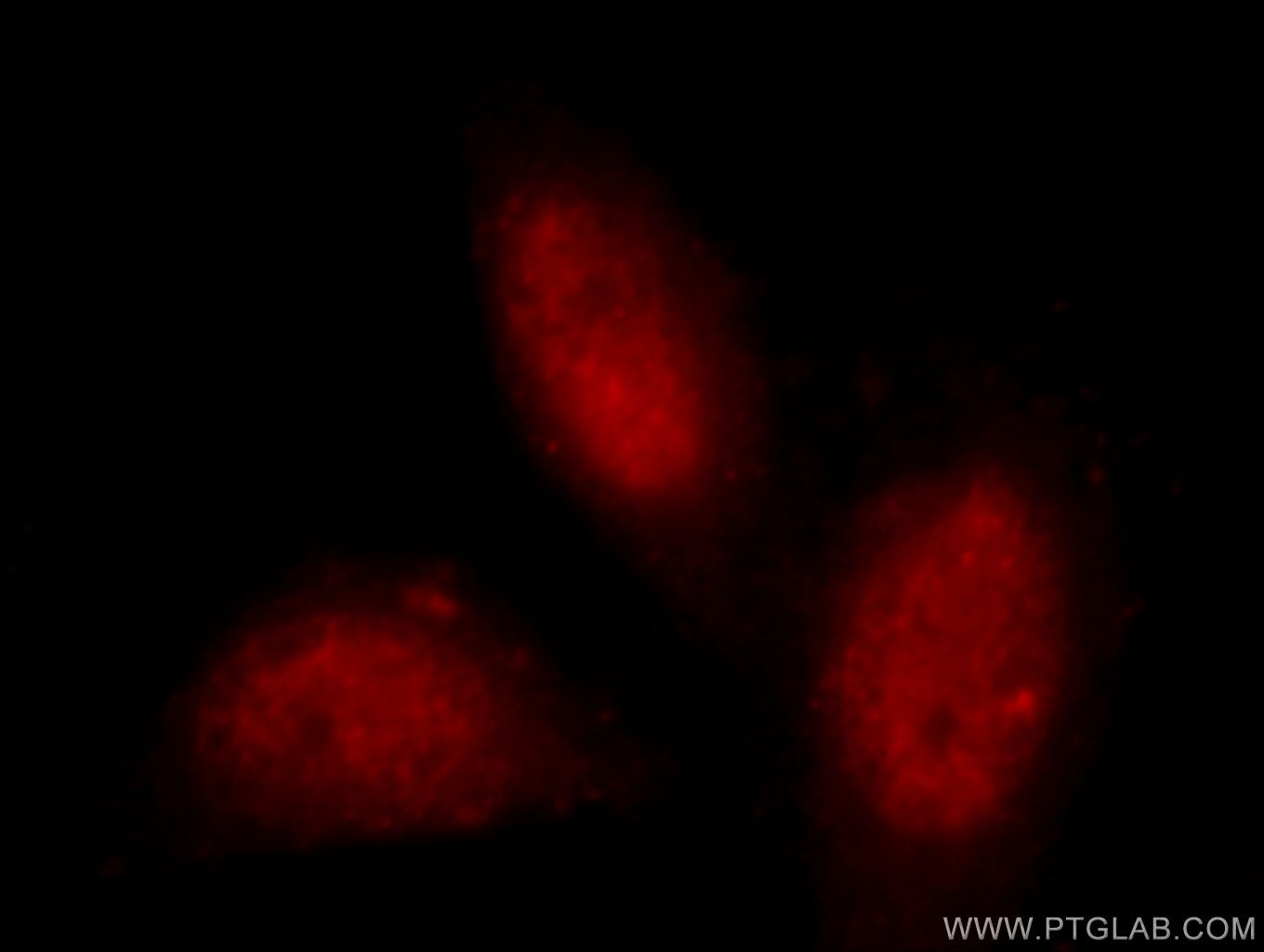 TDP-43 (human specific) Monoclonal antibody