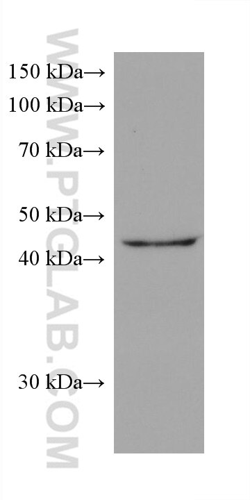 Western Blot (WB) analysis of rabbit brain tissue using TDP-43 (human specific) Monoclonal antibody (60019-2-Ig)
